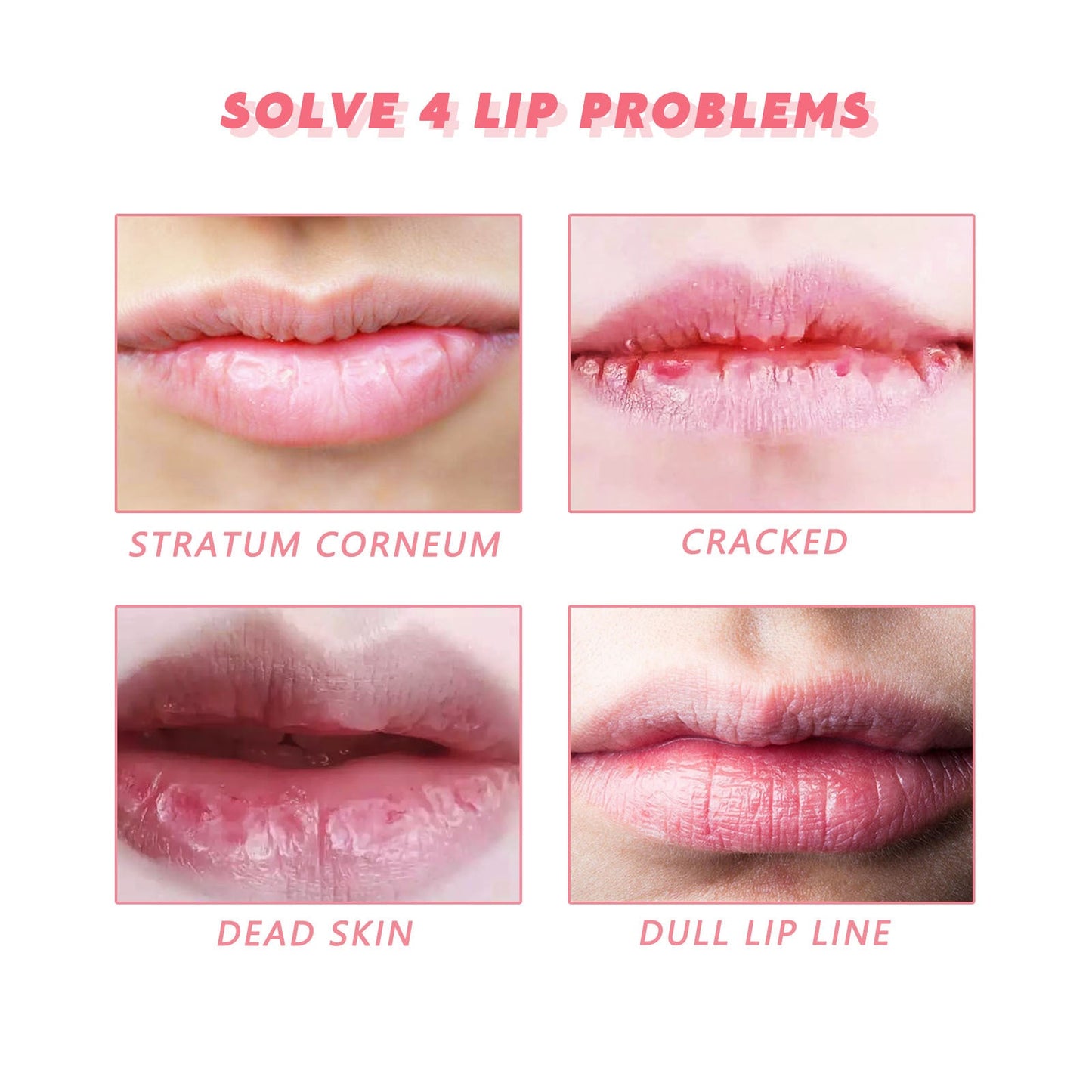 Exfoliante de Labios de Durazno EELHOE Hidratante e Iluminador para Mejorar las Esquinas Oscuras de la Boca