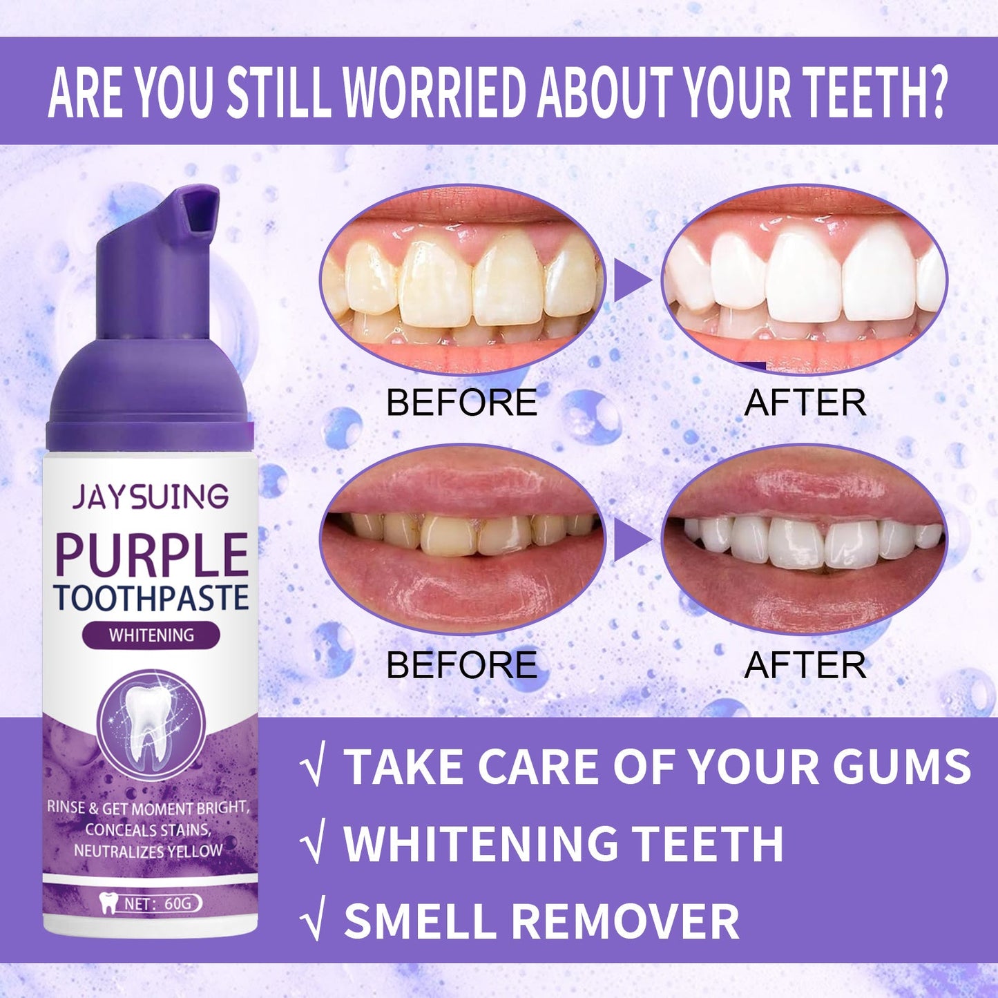 Corrector de Color Morado — Dientes Blancos al Instante