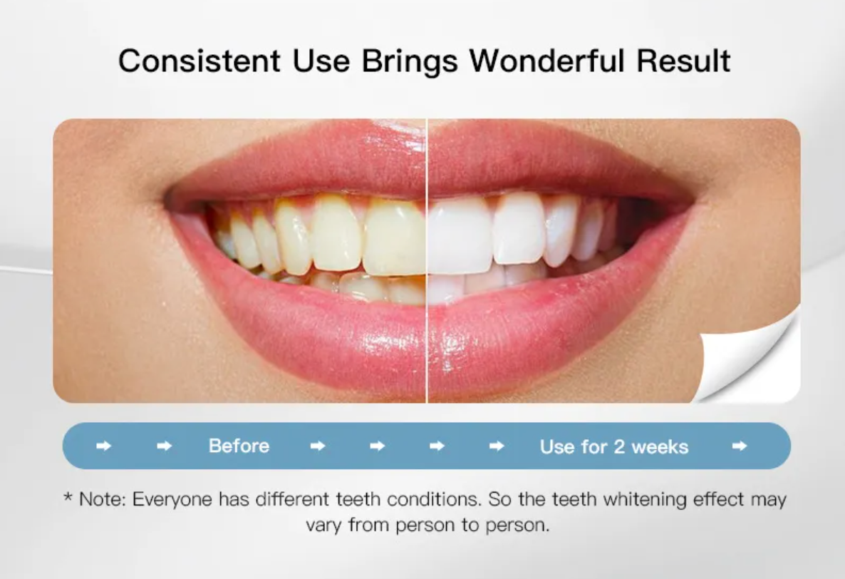 Cepillo de Dientes Sónico Blanqueador en Forma de U