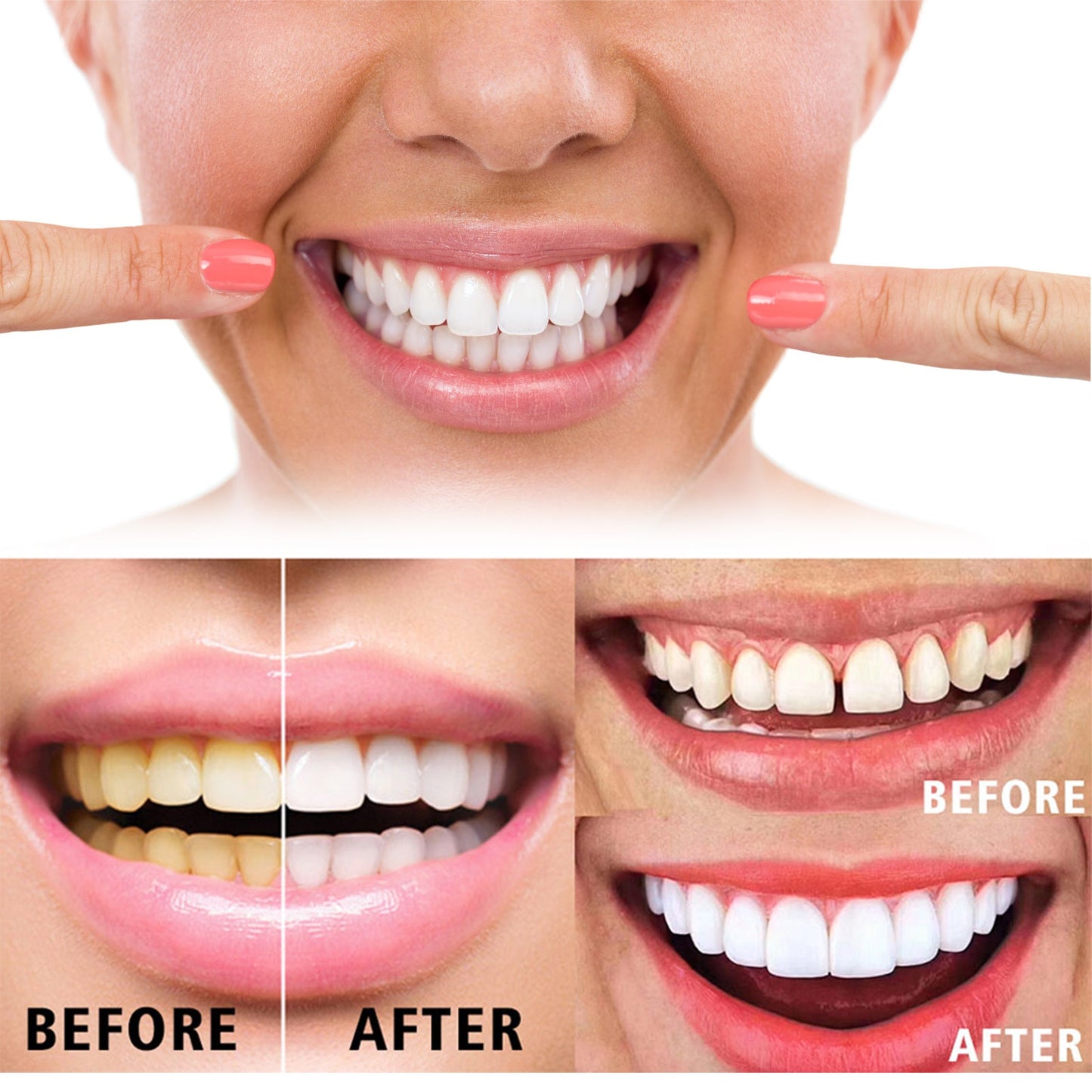 Gel Dental Jaysuing para la Limpieza de Dientes y Aliento